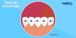 Ortodoncia con brackets metálicos