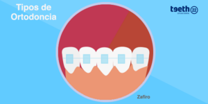 Ortodoncia con brackets estéticos