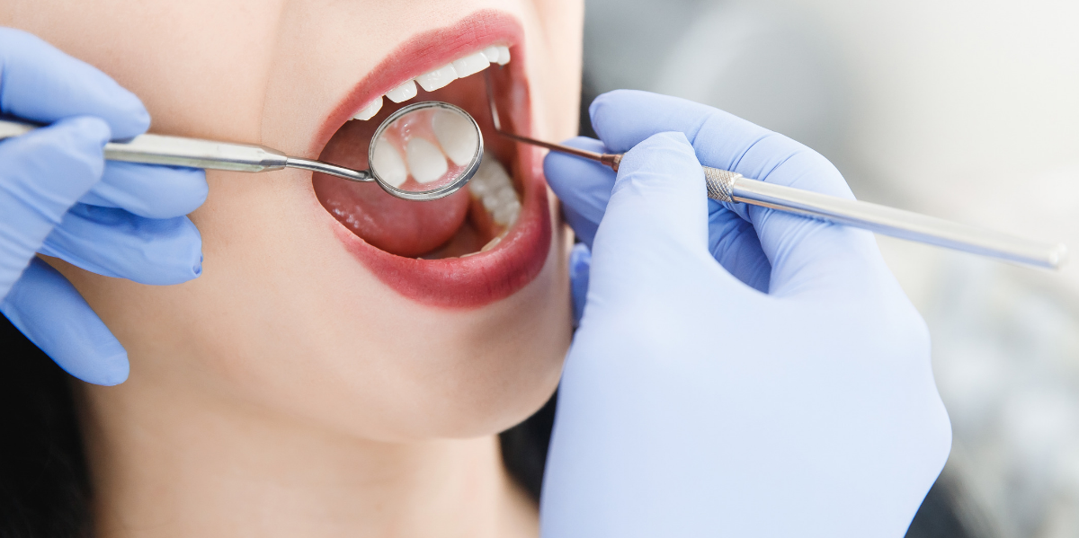 Recesión gingival qué es, sus causas y cómo detenerla